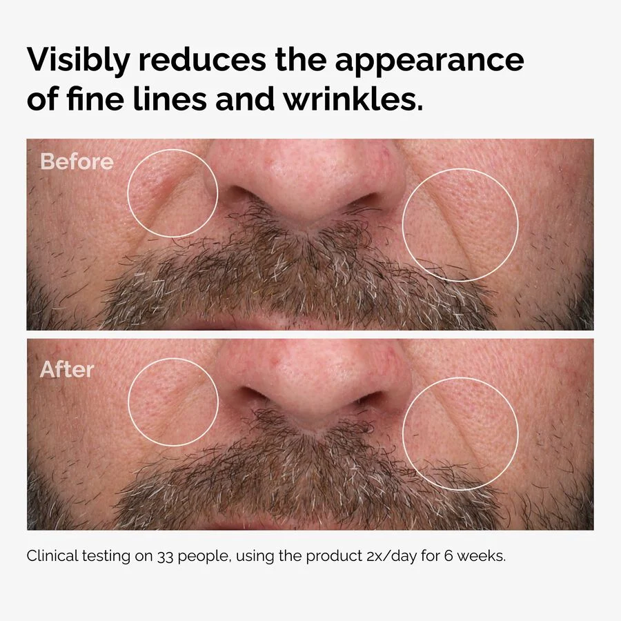 100pct-fermented-rose-hip-before-after-wrinkles