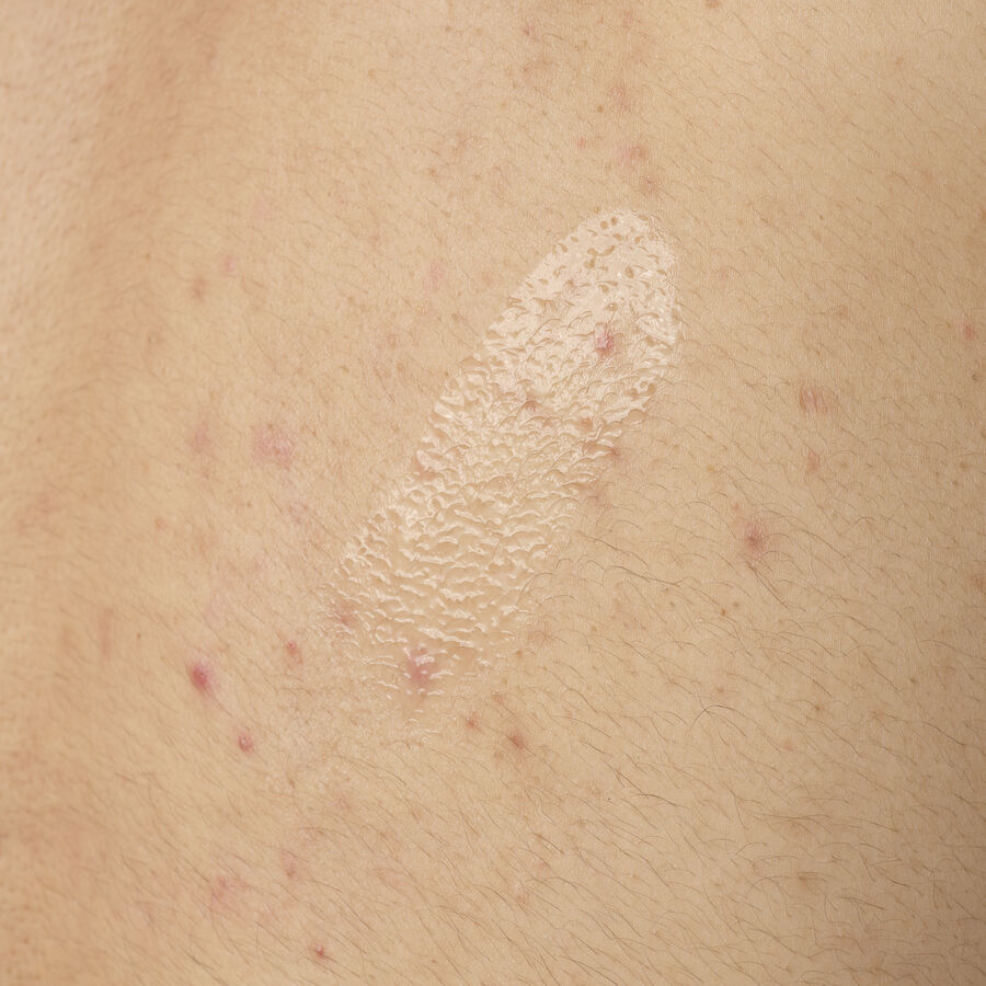 ORD-salicylic-acid-05-body-240ml-application